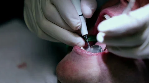 Detail of checking the clients teeth with a mirror Stock Footage 33055508