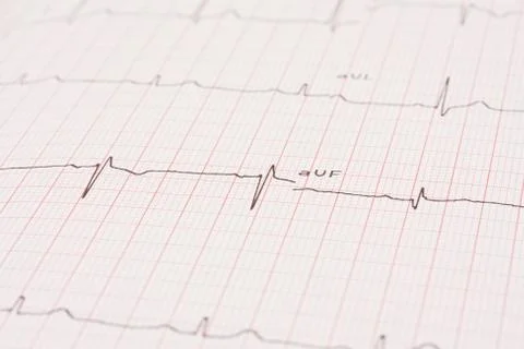 Detail of an electrocardiogram Stock Photos