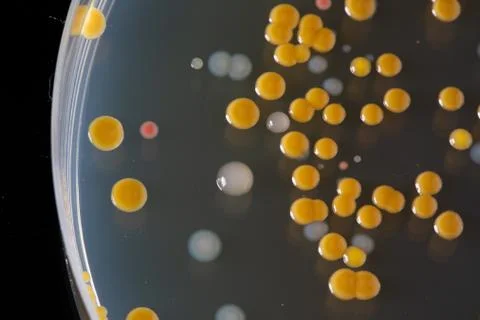 Detail of sample container with bacterial colonies Fotos de archivo