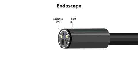 Detailed Animation of Endoscope Tip Components and Functions Video stock 316746063