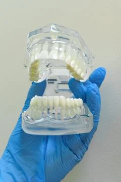 Detailed dental model held in gloved hand showcasing perfect tooth alignment Fotos Stock