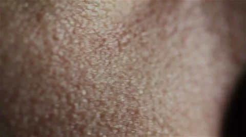 Detailed Skin Vídeos de archivo 44352894