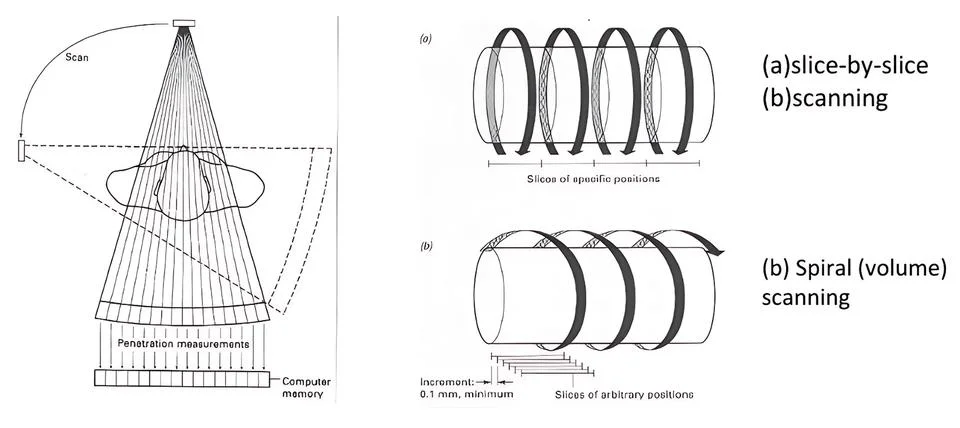 Detailed Visualization of CT Slice-by-Slice and Spiral Volume Scanning for .. Stock Photos