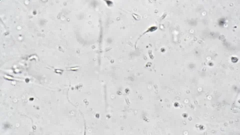 Detailed visualization of sperm cells movement and morphology in laboratory Stock Footage 343952060