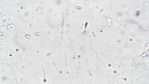 Detailed visualization of sperm cells movement and morphology in laboratory Stock Photos