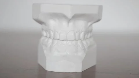Details from a gypsum casting model from a man's teeth used for surgery study Vídeos de archivo 169975794