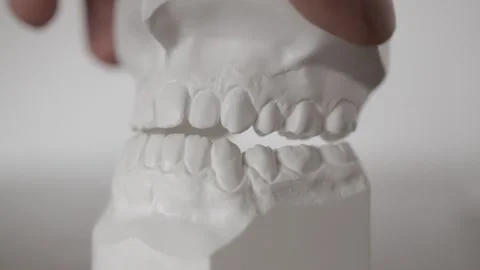 Details from a plaster model from a man's teeth used for surgery study Stock Footage 169975780