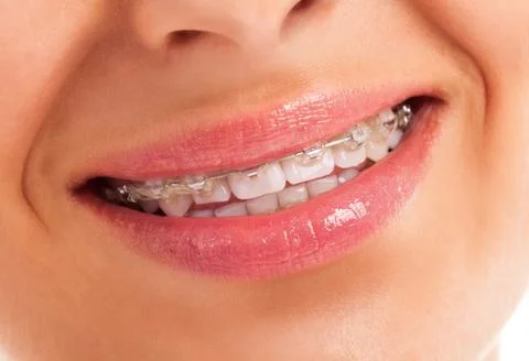 Details of teeth Stock Photos