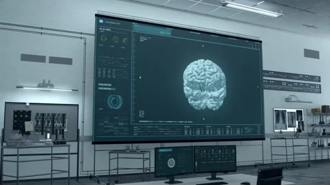 Detecting a big tumour after the analysis of patients brain at the laboratory Video stock 195205274