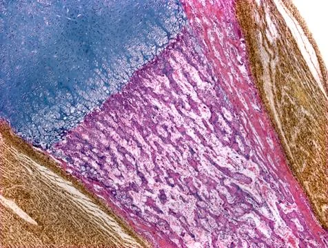 Developing bone, light micrograph Stock Photos