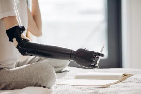 Development in prosthetic arm systems Stock Photos