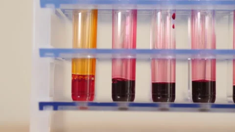 Deviant blood sample in line up of test tubes. Close up. Stock Footage 142796655