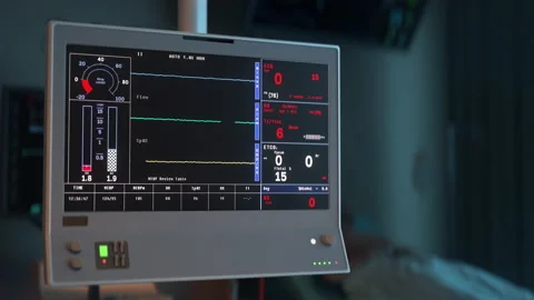 Device is detecting the quick decline of the patients life markers at a clinic Stock-Footage 190545053