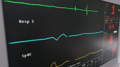 Device displaying the flatline heartbeat graph of a sick patient at the hospital Stock Footage 278041516