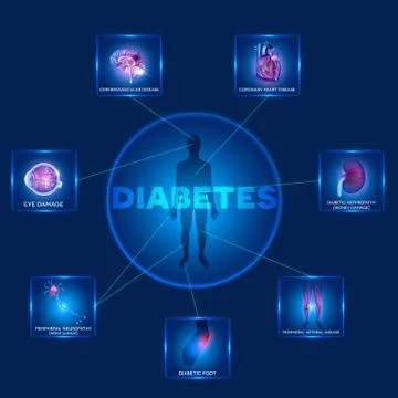 Diabetes affected organs Stock Illustration