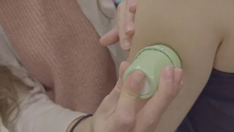 Diabetic CGM sensor Stock Footage 329315891