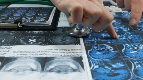 Diagnosis of the disease Stock Footage 89833599