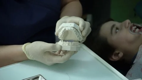 The diagnostic phase of bite correction. Plaster pattern of children's teeth. HD Stock Footage 71765880