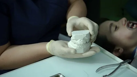 The diagnostic phase of correcting bite. Plaster model of children's teeth. HD Video stock 72189030
