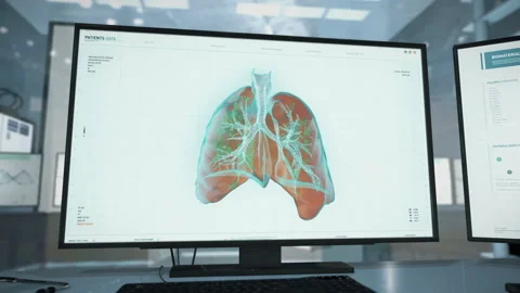 Diagnostic Process To Analyze Health Condition In Futuristic Computer Program Stock Footage 160071297