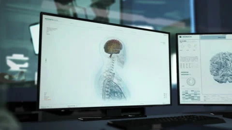 Diagnostic software is scanning the human brain at the modern medical laboratory Stock Footage 159049660