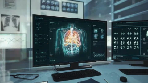 Diagnostic x-ray technology is searching for cancerous infection in the lungs Stock Footage 248555661