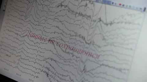 Diagnostics Stock Footage 8838600