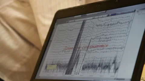 Diagnostics 動画素材 8838617