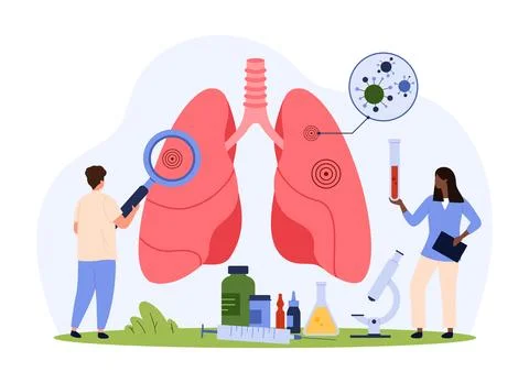 Diagnostics of lung disease, pulmonology, tiny people check lungs with Stock Illustration