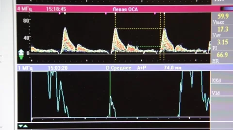 Diagrams Stock Footage