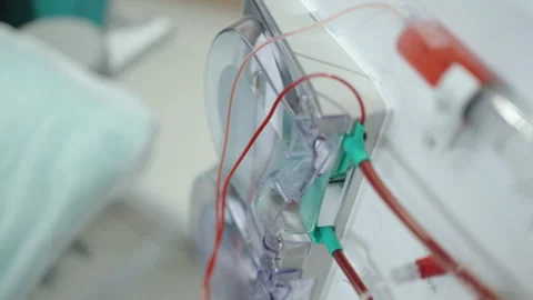 Dialysis Circuit Lines Connected to Transparent Pump Housings Close Up Stock Footage 338424624