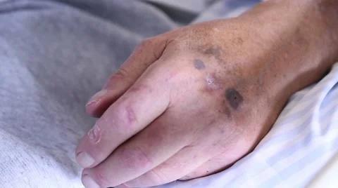 Dialysis Stock Footage 8683546