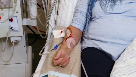Dialysis in a hospital Video stock 79731696
