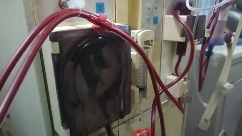 Dialysis Machine Pump closeup 動画素材 233917715
