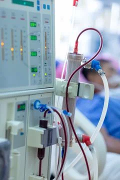 Dialysis machine is working. Acting as a substitute for the kidneys to drive Stock Photos