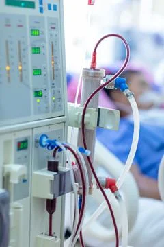 Dialysis machine is working. Acting as a substitute for the kidneys to drive Stock Photos
