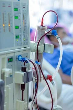 Dialysis machine is working. Acting as a substitute for the kidneys to drive Stock Photos
