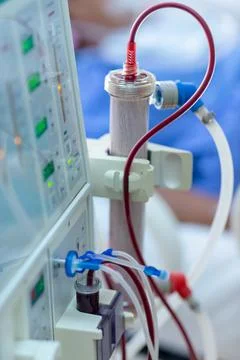Dialysis machine is working. Acting as a substitute for the kidneys to drive Stock Photos