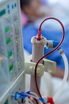 Dialysis machine is working. Acting as a substitute for the kidneys to drive Stock Photos
