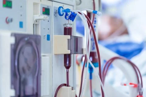 Dialysis machine is working. Acting as a substitute for the kidneys to drive Stock Photos