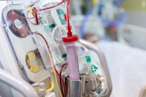 Dialysis machine is working. Acting as a substitute for the kidneys to drive  Stock Photos
