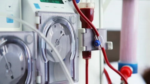 Dialysis medical device with patient Stock Footage
