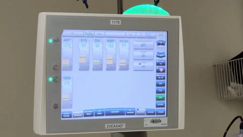 Dialysis screen close up with real data Stock Footage 331807991