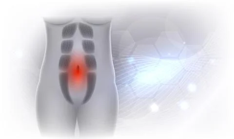 Diastasis Recti on an abstract background Stock Illustration