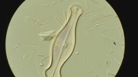 Diatom algae cell walls made of silica under microscope, DIC contrast Vídeos de archivo 65773950