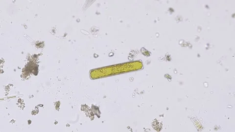 Diatom algae with elongated frustule under the microscope Stock Footage 328630667