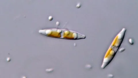Diatom and bacteria under DIC microscopy 库存影片 317253981