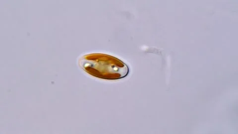 Diatom Bloom Seen Under the Microscope 库存影片 317254324