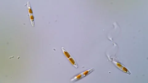 Diatom Colony Observed Under Microscope Vídeos de archivo 317254218