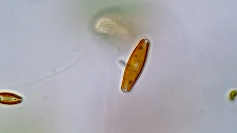 Diatom Frustules Under Brightfield Microscopy 스톡 동영상 317254215